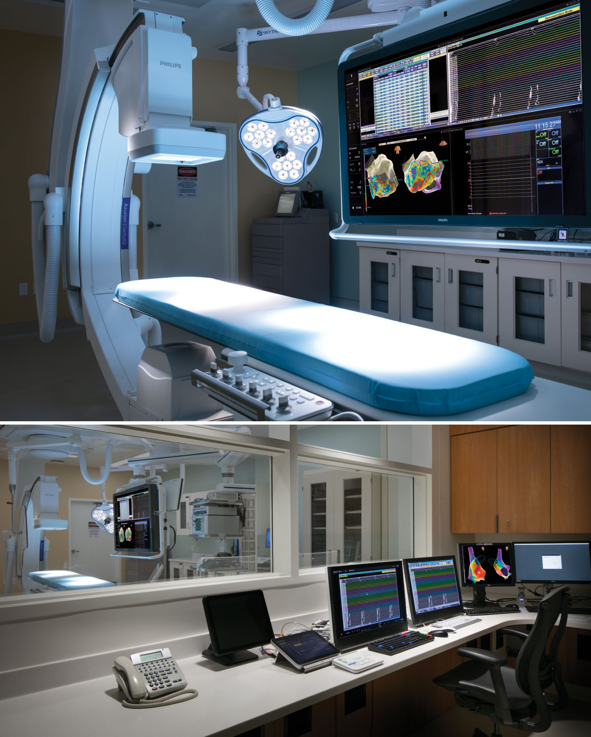 Community Hospital’s state-of-the-art electrophysiology lab